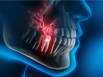 emergency dentist in east cobb marietta